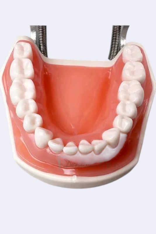Modèle dentaire - compatible Nissin