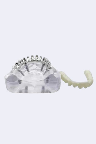 DENTISTOOLBOX dental model showing full bridge restoration on implants, clear acrylic base.